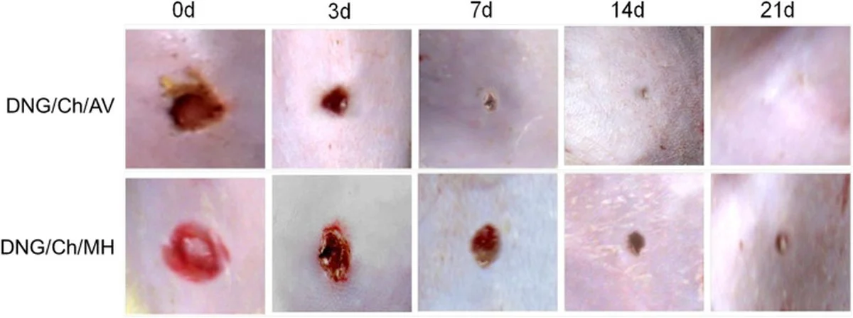 Lžička medu na jizvy? Dermatologové potvrzují jeho nečekané léčivé účinky.