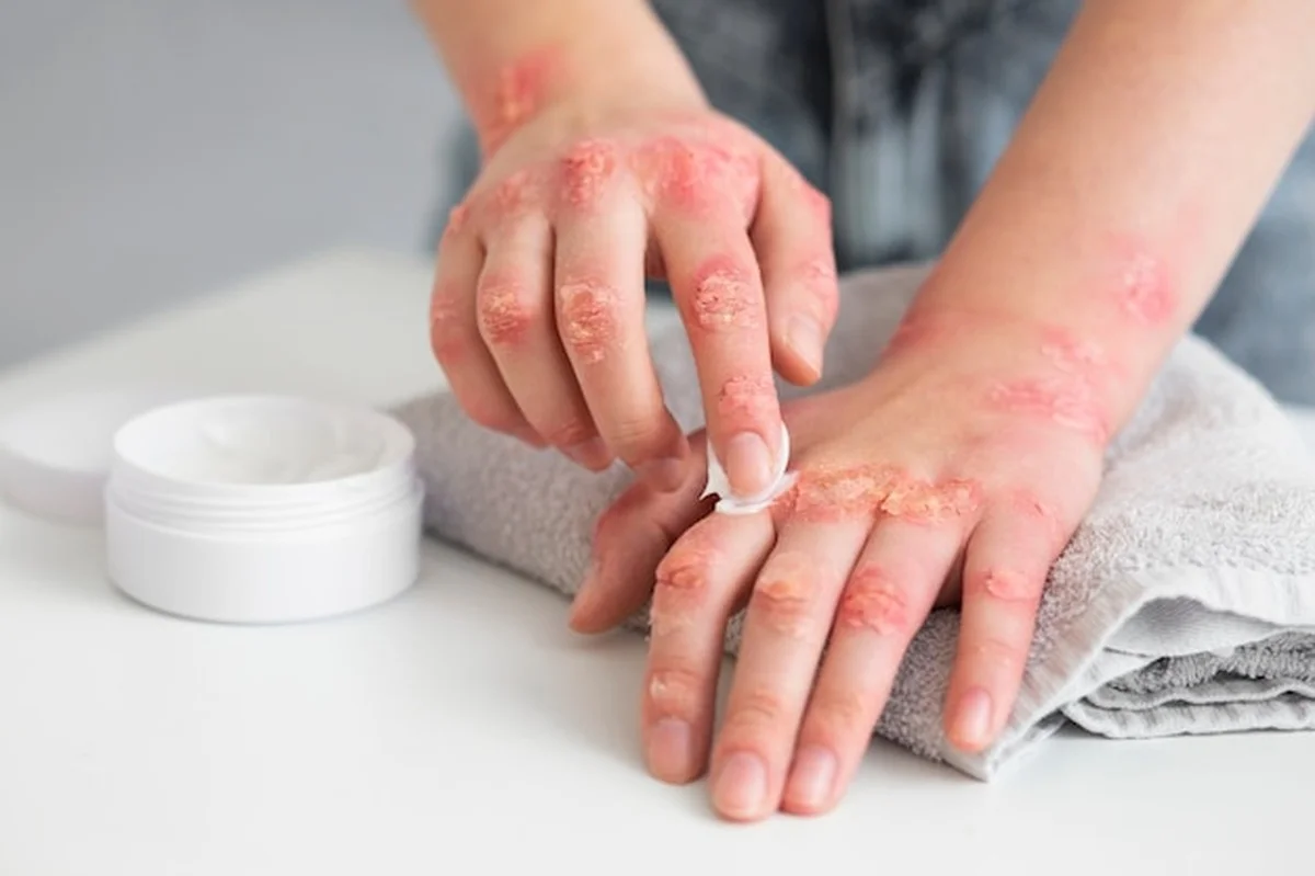 Dermatologové jsou překvapeni: Obyčejná česká potravina, která zabraňuje suché zimní pleti - image 1